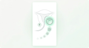 Day 5 IVF Embryo Transfer