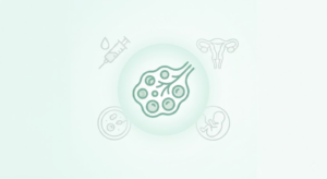 PCOS IVF